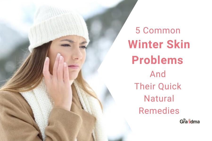 5 Common Winter Skin Problems and their quick natural remedies - ByGrandma